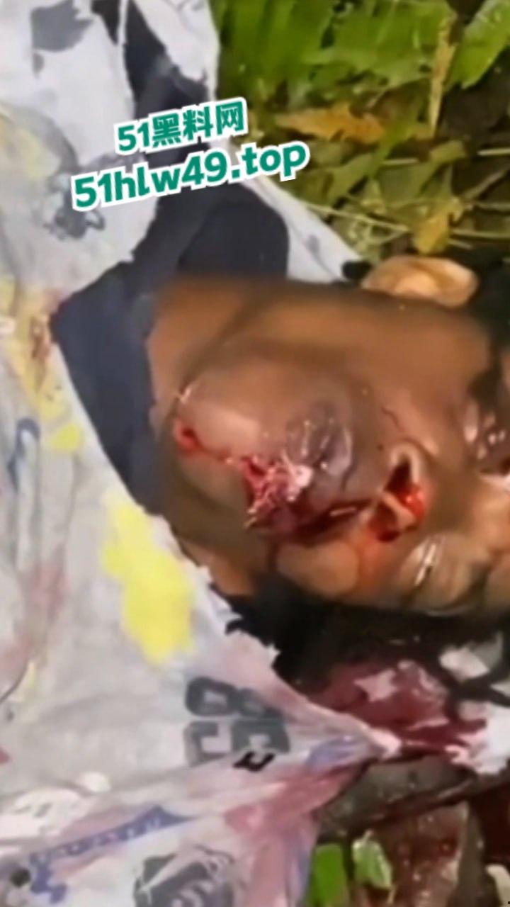 血腥恐怖,非洲南部车祸乡间公路步行,司机未看清路况当场将撞飞路人,手脚全断死相极其残忍。-2