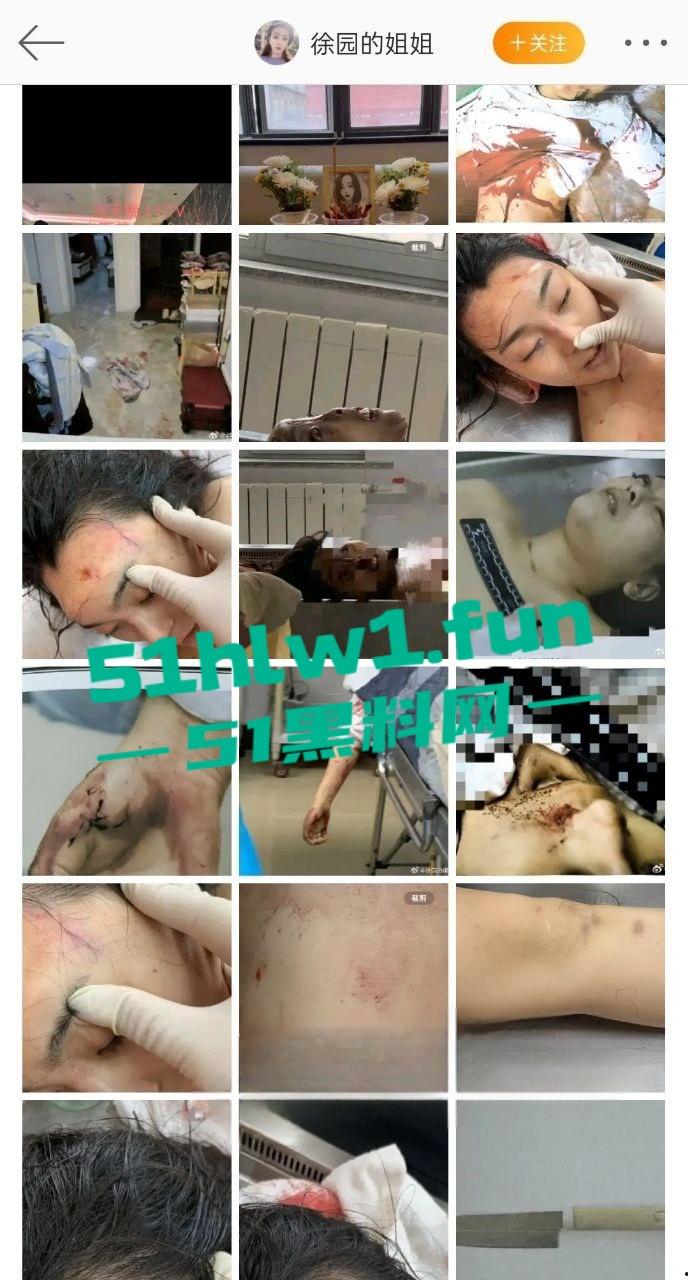 大连女孩【徐园】惨死男友家中,男友却被判无罪,案件再度发酵,尸检细节曝光震惊全网!-4