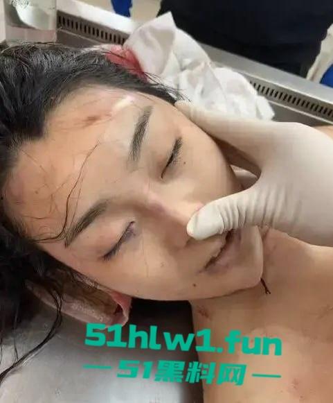 大连女孩【徐园】惨死男友家中,男友却被判无罪,案件再度发酵,尸检细节曝光震惊全网!-6
