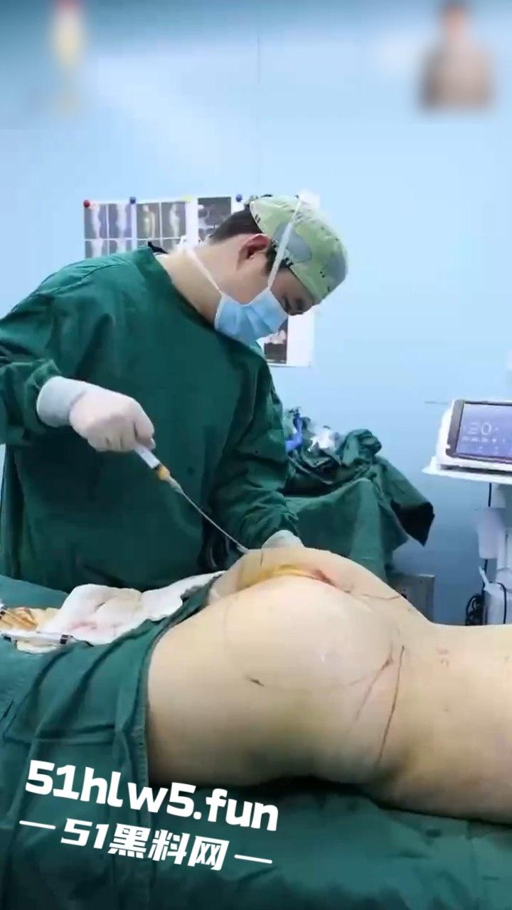 实拍整形医院,小仙女整容抽脂和填充全过程,看着残忍但做完后惊艳的效果让人震撼。-7