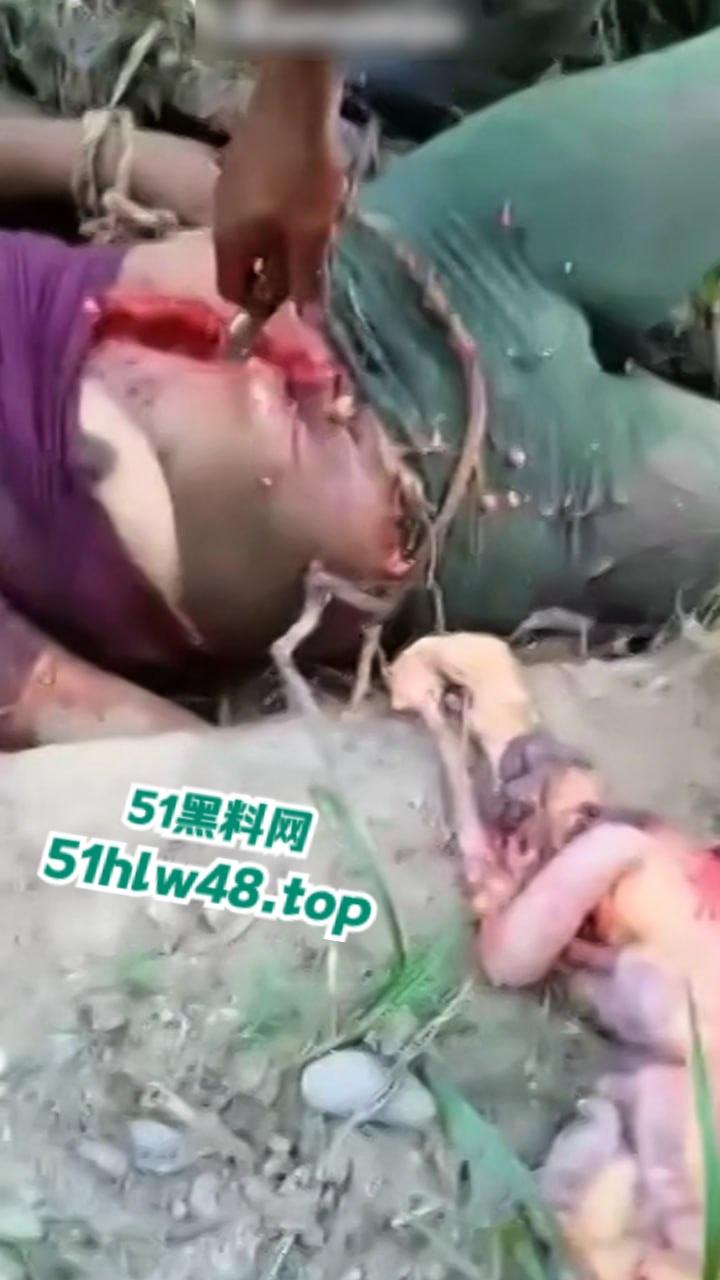 【恐怖血腥】国外大奶美女剖尸现场视频,大坨内脏被扯出,大奶美女和肥猪没啥区别。-2