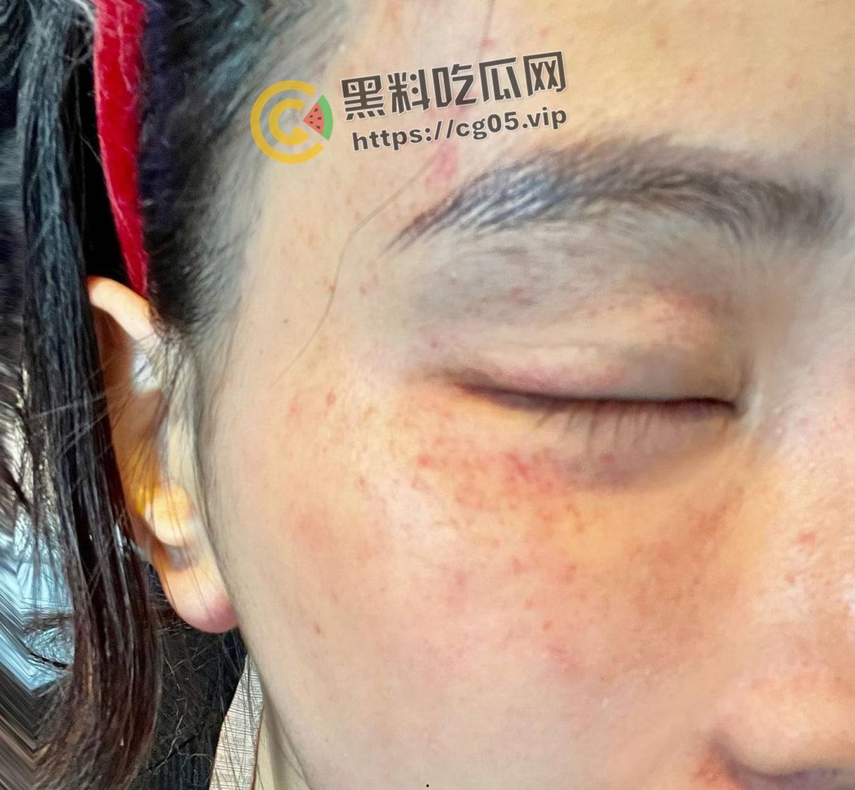 上海鸭王【闫啸天】和鸡婆的狗血爱情故事！鸭王性病 偷吃打鸡婆打到流产 属于是烂人比烂 家暴现场血腥画面流出-10