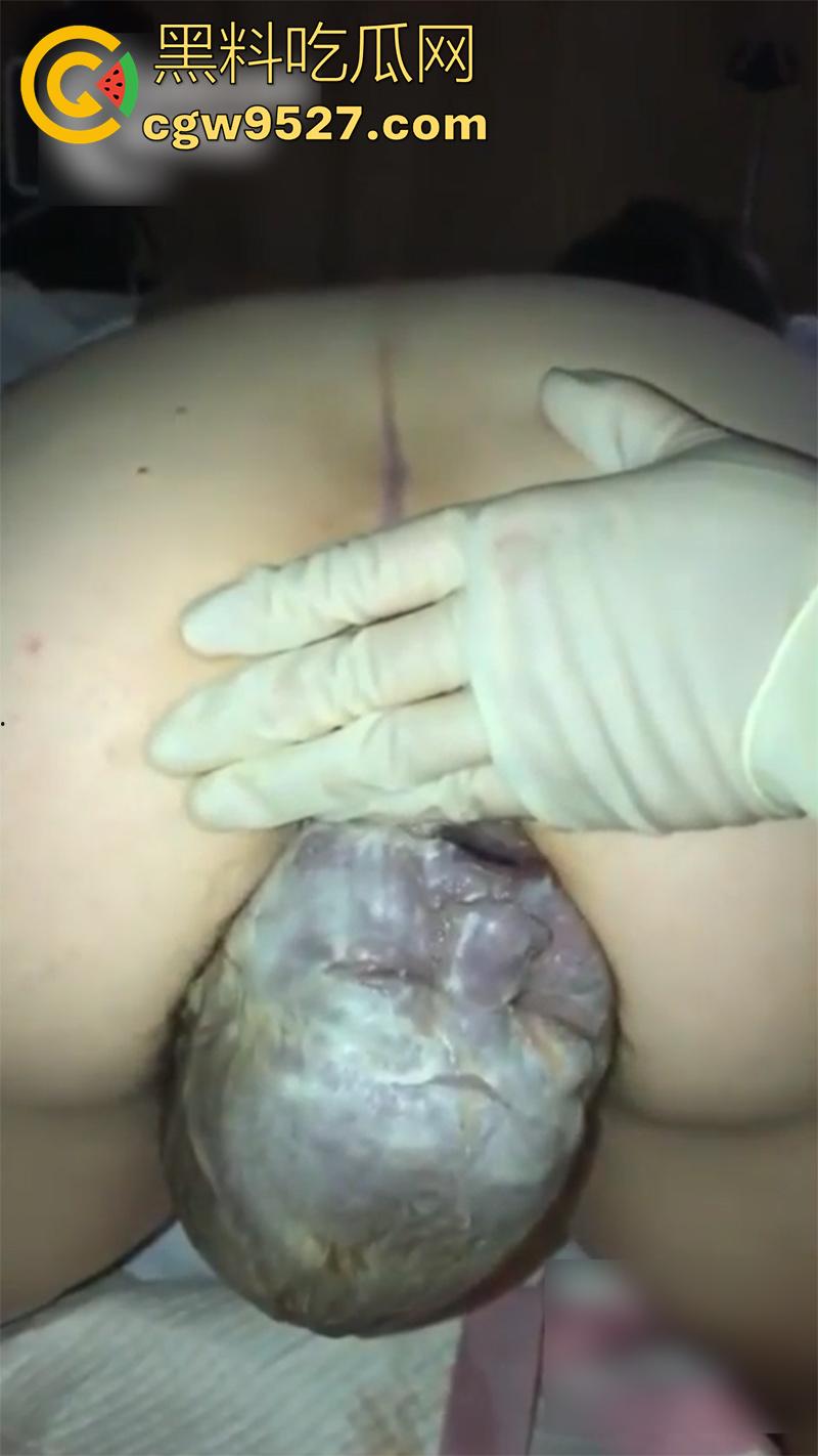 孕妇接生现场画面，体验生孩子的全过程，幸亏是个大肥逼，不然一定痛死了，原来大家都是这么来的啊！-5