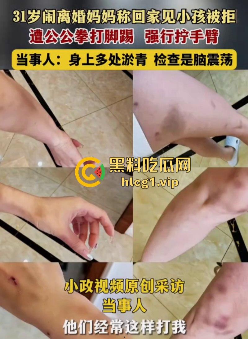 离完婚就不能见小孩?江苏泰州女子回家看小孩遭公公拳打脚踢!-1