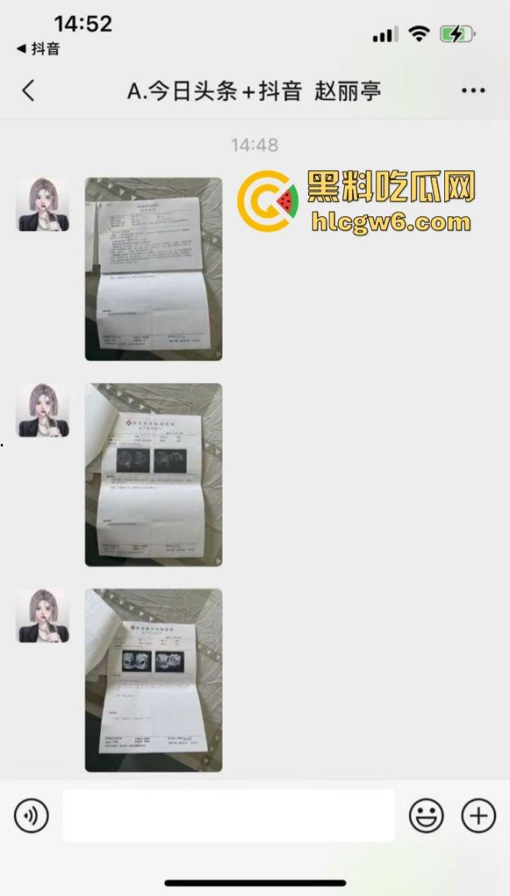 山西汾阳【赵丽婷】婚内出轨 结婚五年频繁出轨并打胎5次 被老公曝光并附带视频！-1