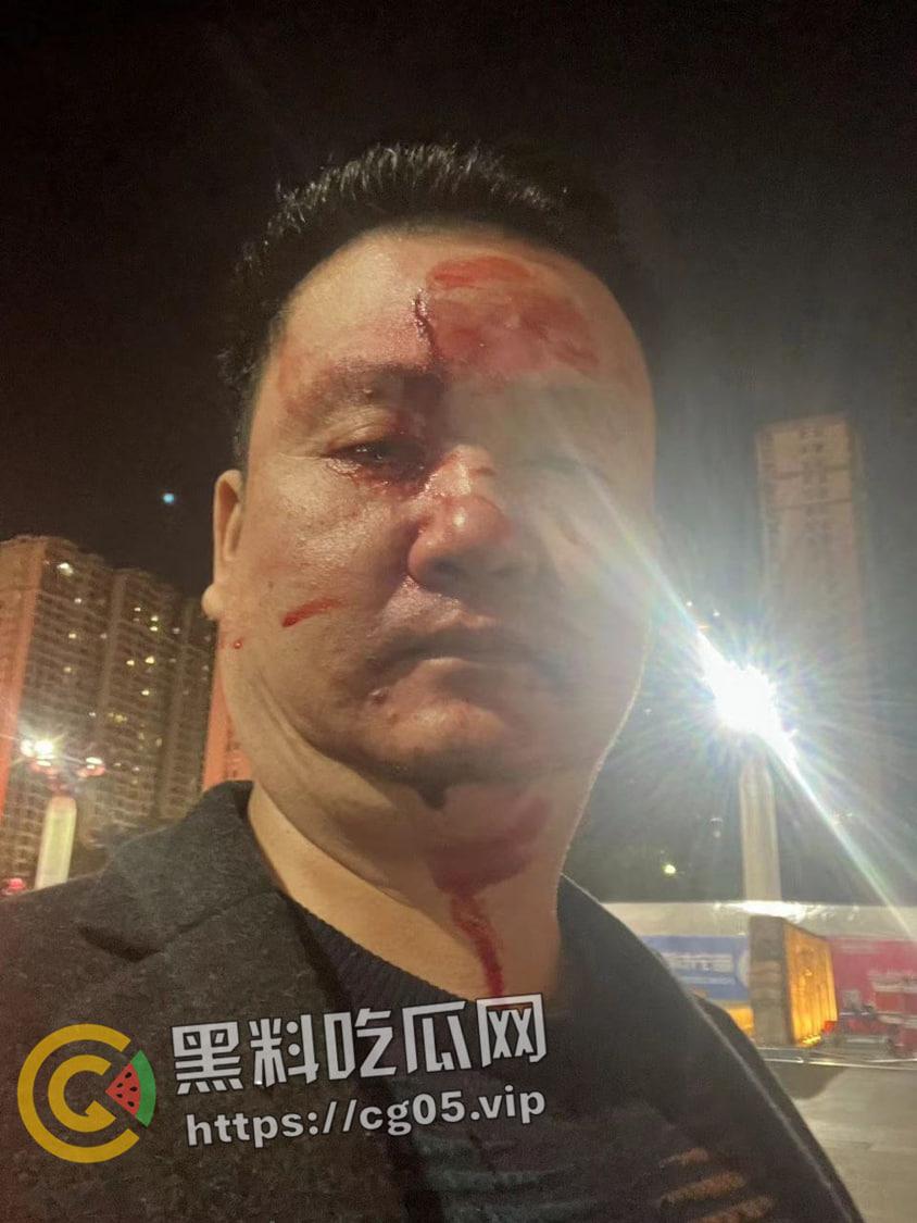 群友约架 不打你不是吴林风!广东普宁池尾两老登【吴林丰】【广武】聊天群内约线下打架 直接真实 打到满脸血 是兄弟就来打我-3