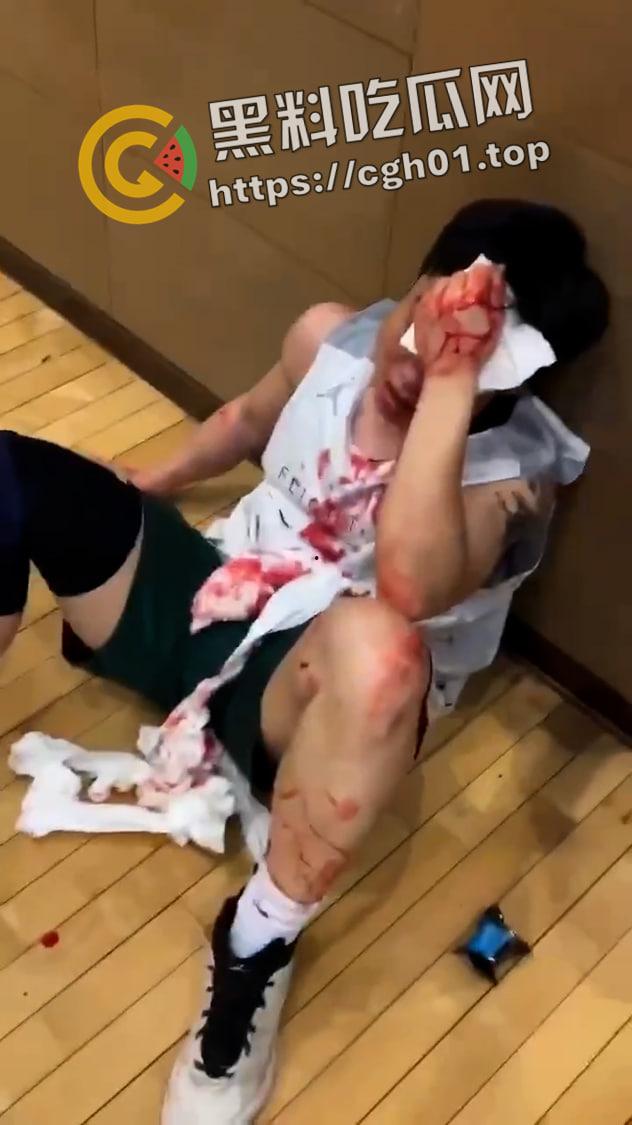 一场野球挣了66w！广州汇悦台野球场暴躁男【王帅】打球带肘给人开瓢   赔66w才能免坐牢-5