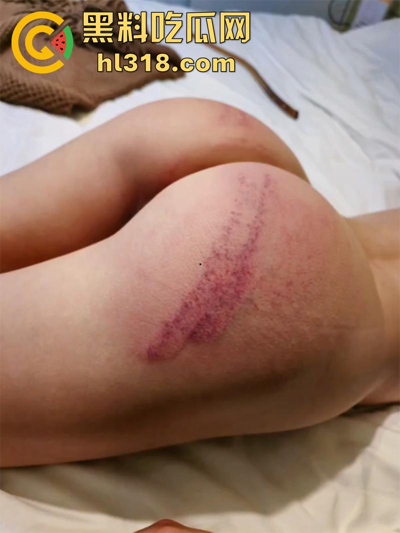 高颜值翘臀母狗，被调教打屁股虐阴合集，自愿当公交车被人轮流操，抽奶扇耳光抽到起飞，淫水都淌拉丝了！-3
