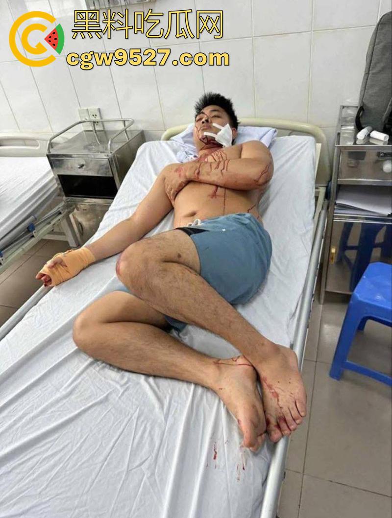 越南海防水果批发市场，发生重大砍人事件，男子手持菜刀疯狂劈砍，导致三人身受重伤，现场视频流出！-4