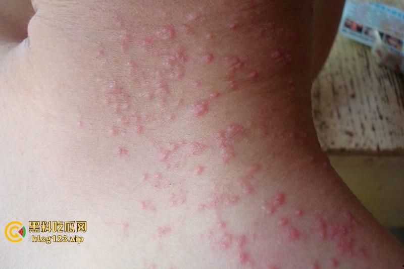 可怕！为了报复社会把带血针头扎进了共享单车的座椅里……山东商业技师学校20个被感染艾滋！！！-8