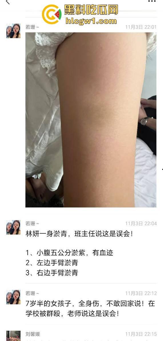 广州金隆小学曝惊天丑闻！初中学生遭体罚虐待，遍体鳞伤，家长被辱骂怒火中烧！-2