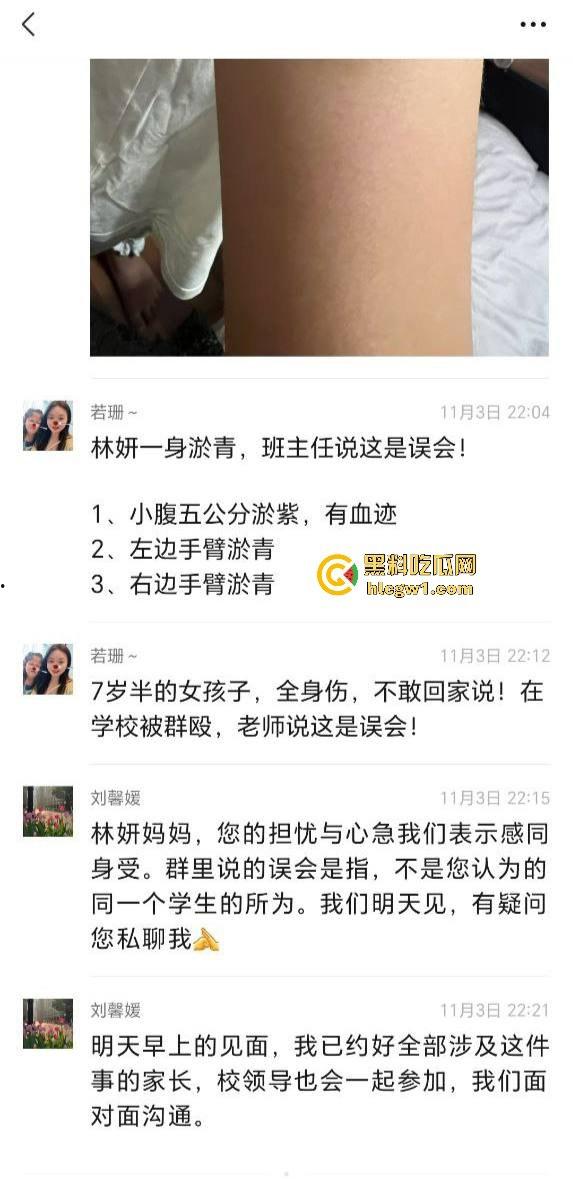 广州金隆小学曝惊天丑闻！初中学生遭体罚虐待，遍体鳞伤，家长被辱骂怒火中烧！-3