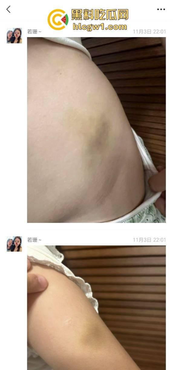 广州金隆小学曝惊天丑闻！初中学生遭体罚虐待，遍体鳞伤，家长被辱骂怒火中烧！-11