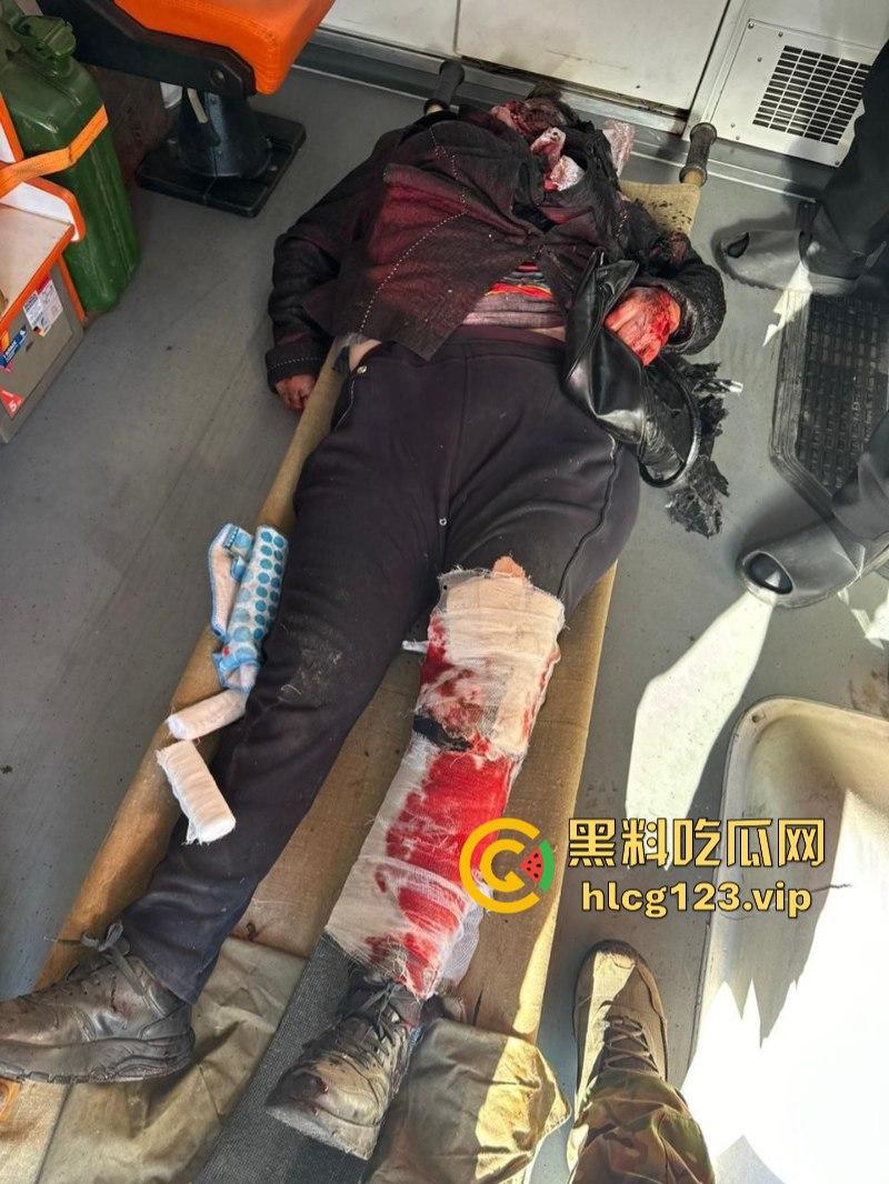 坐等看戏！伊朗对以色列的导弹袭击已结束 美准备好对抗伊朗？内含血腥无码画面 慎入！！！-6