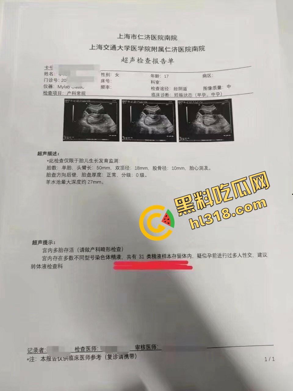 瓜友投稿女友身体不适去医院，体内查出31种精液化身精液小型联合国，当场自闭分手曝光手机视频！-1