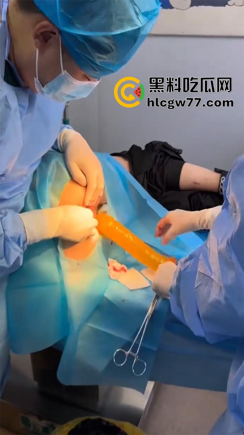 成都肛肠科又来新活，巨屌玩具塞入菊花拔不出来，只能到医院取出，这么大怎么塞进去的呢？-8
