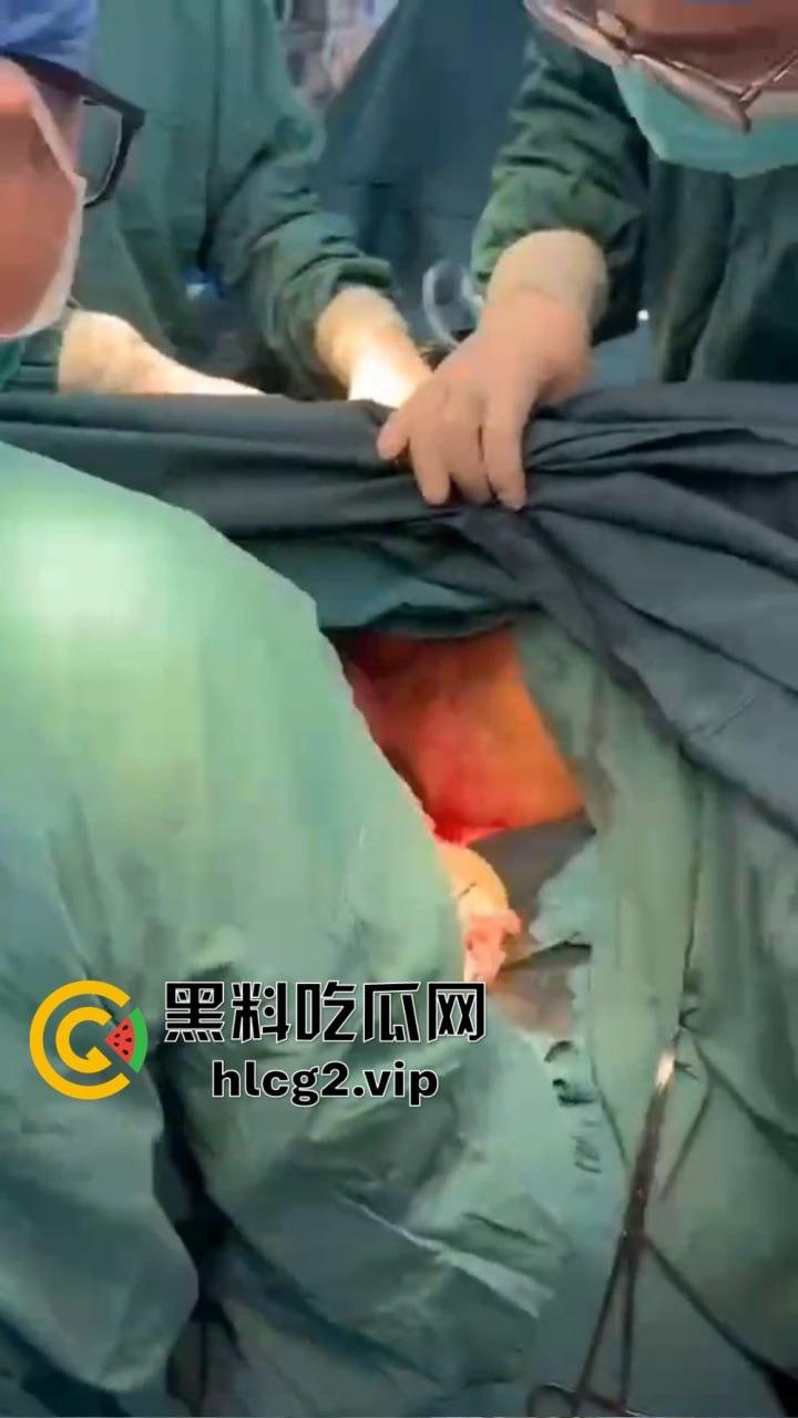 重口慎点！男子硬塞20厘米假体进体内，女子螃蟹夹逼狠整，为了流量太拼了！-9