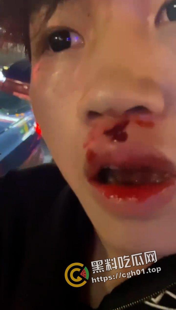 抖音网红【李金帅】街头惹事被暴打 恶人自有恶人磨 这下不嚣张了-3