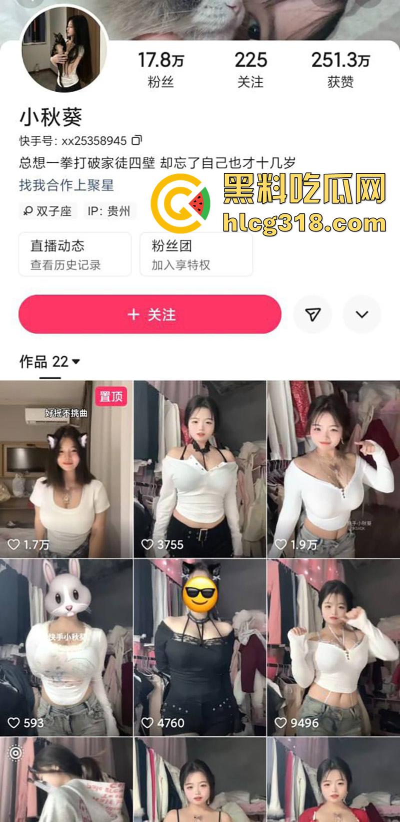 国产童颜巨乳【小秋葵】，美乳又大又白嫩，快手擦边勾引大哥，穿诱人情趣蕾丝秀完美酮体！-1