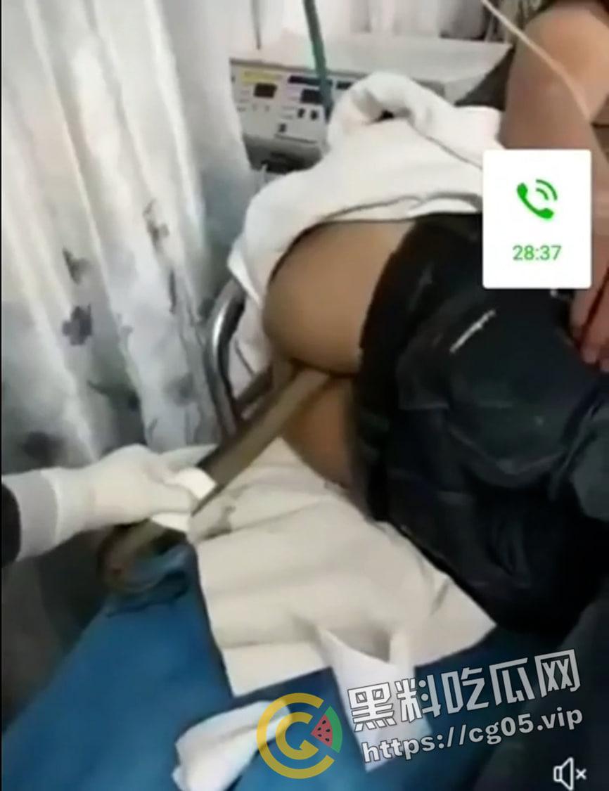 黄鳝入肛 一去不回 整活把自己整进医院了 医生扯出来半米长的黄鳝惊呆了-1