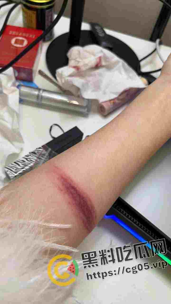 抖音女主播PK失败后自虐 滴蜡在胸上 生吃点燃的香 皮筋弹手臂 多少有点受虐癖 老夫怀疑你就是好这口才输的-5