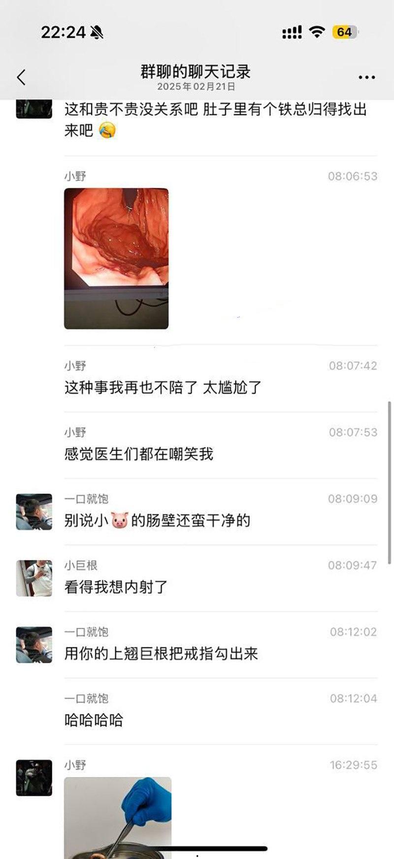 真刺激!男模激情拳交玩过火,结果金戒指卡屁眼里,深夜紧急送医取出,医生直叹牛逼-10