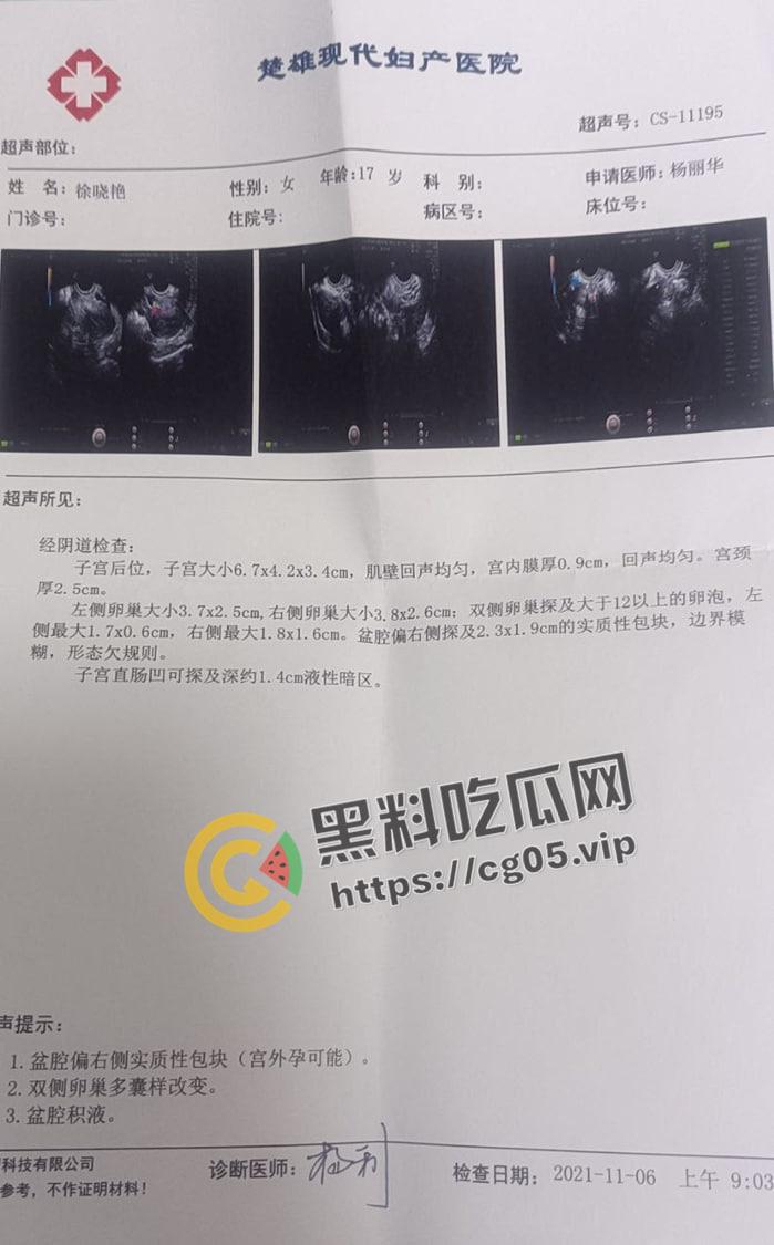 楚雄医专【徐晓艳】宫外孕 分手后私密照片视频被前男友流出 调教自拍 摁头爆操 妥妥的母狗肉便器-14