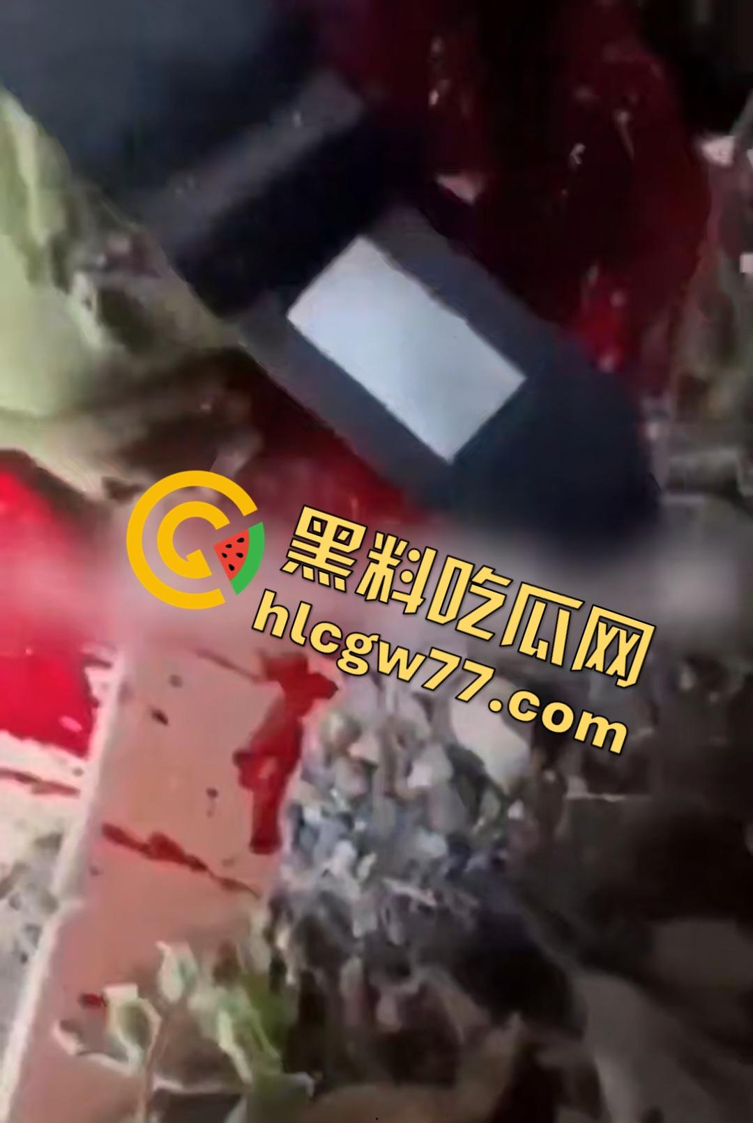 俄乌战场出现食人兵?士兵炸弹炸飞手臂骨髓喷溅,一旁队友饿了还吸食血液充饥!-1