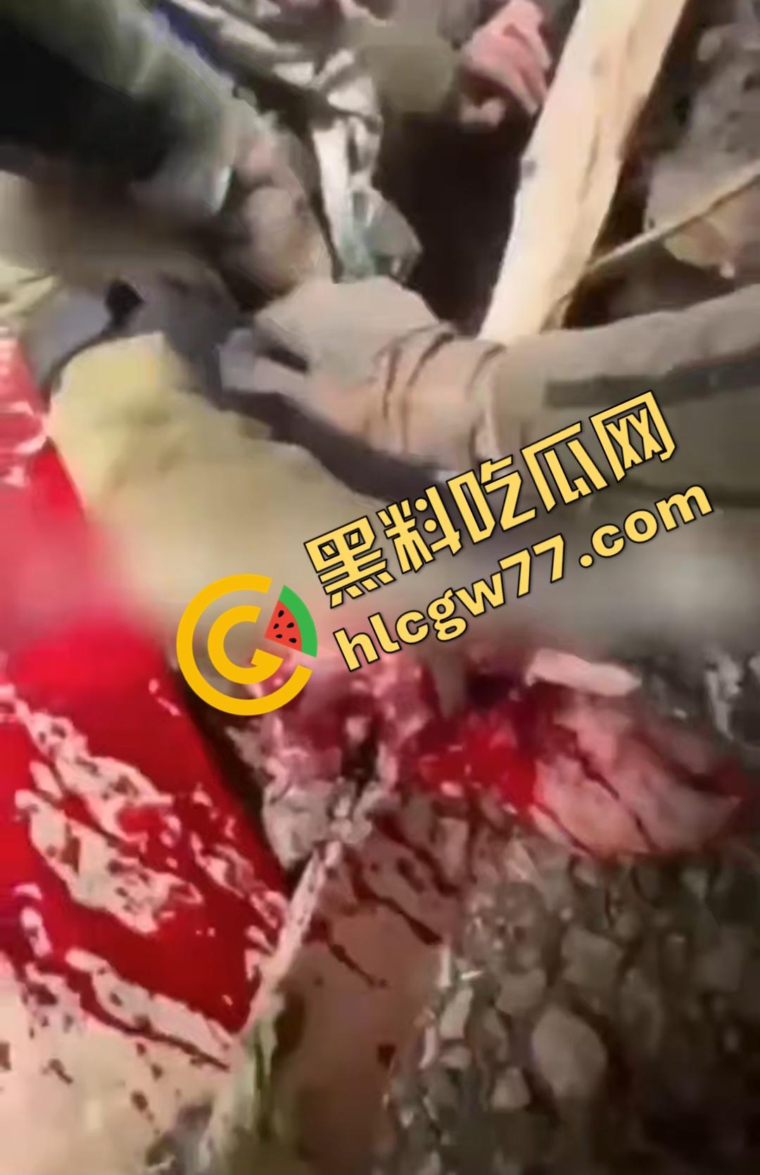 俄乌战场出现食人兵?士兵炸弹炸飞手臂骨髓喷溅,一旁队友饿了还吸食血液充饥!-2