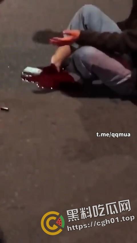 摩托车女骑士装上大货车 小腿直接断掉 现场血腥画面流出-5