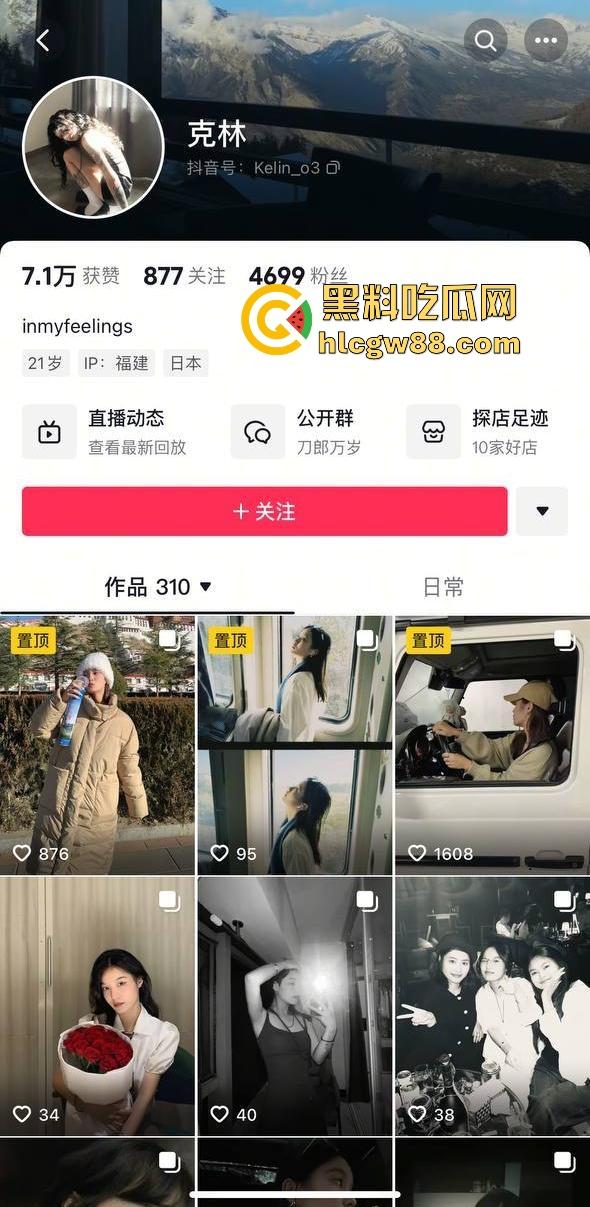 抖音厦门母狗【黄淮北】到处约炮聊骚居家狂热自慰 出去约炮时胸口的挂坠被实锤本人无疑!-1