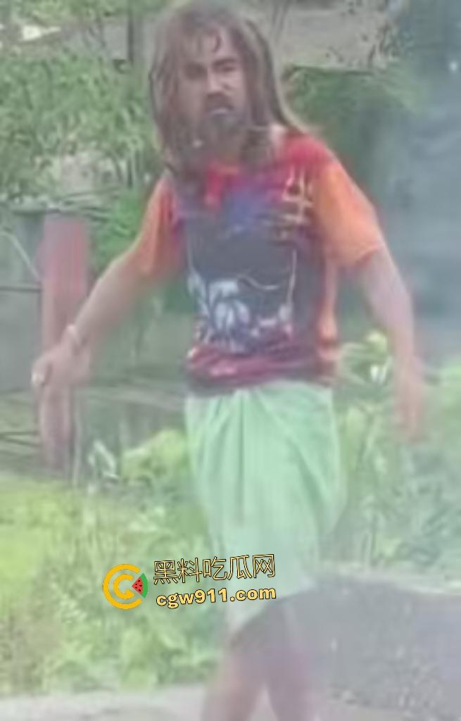 英国穷鬼流浪汉狠炸自己!老婆跑路绝望拿鞭炮塞嘴自爆折磨,威力太小没死成却逗乐路人狂笑!-4