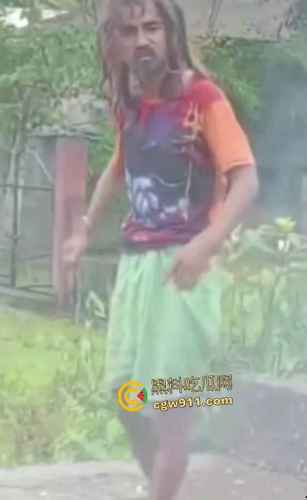 英国穷鬼流浪汉狠炸自己!老婆跑路绝望拿鞭炮塞嘴自爆折磨,威力太小没死成却逗乐路人狂笑!-6