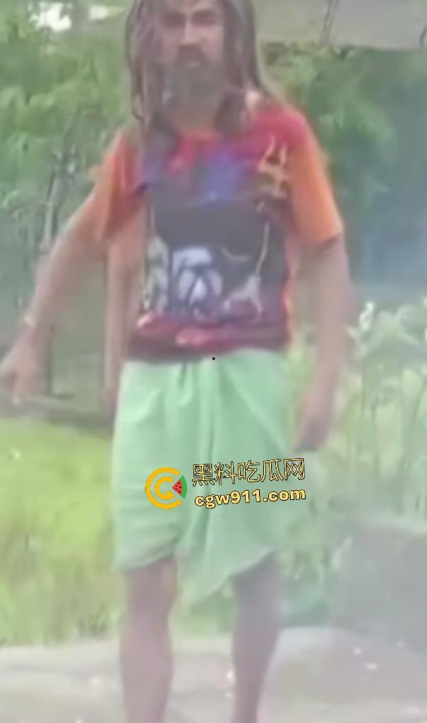 英国穷鬼流浪汉狠炸自己!老婆跑路绝望拿鞭炮塞嘴自爆折磨,威力太小没死成却逗乐路人狂笑!-7