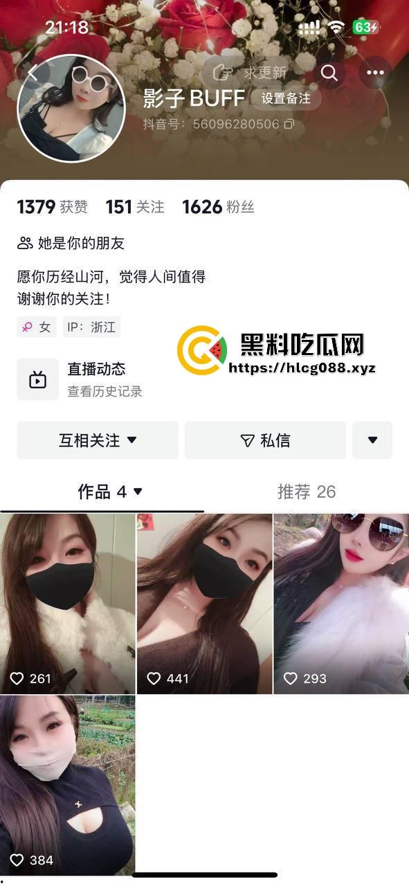 浙江少妇【影子buff】反差母狗私拍猛料炸街，2月最新定制片抖音卖得满地骚，加个好友私聊就甩微信开干！-1