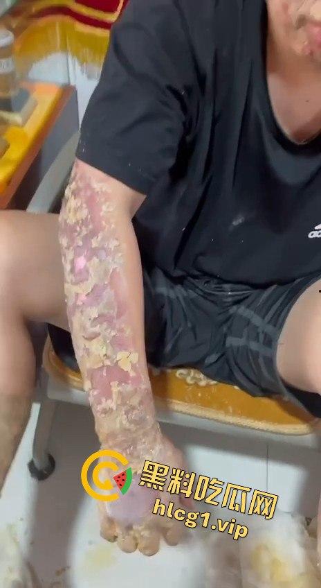 内蒙古呼和浩特惊魂一刻！02年精神小伙偷骑V4机车撞上右转SUV，摩托车当场燃烧！-9