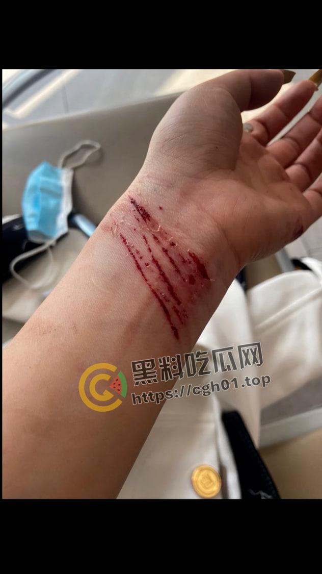 抖音三千万粉丝网红【董先生】被实名举报强奸 警察局不予受理 是手大遮天还是臭网红炒作-11