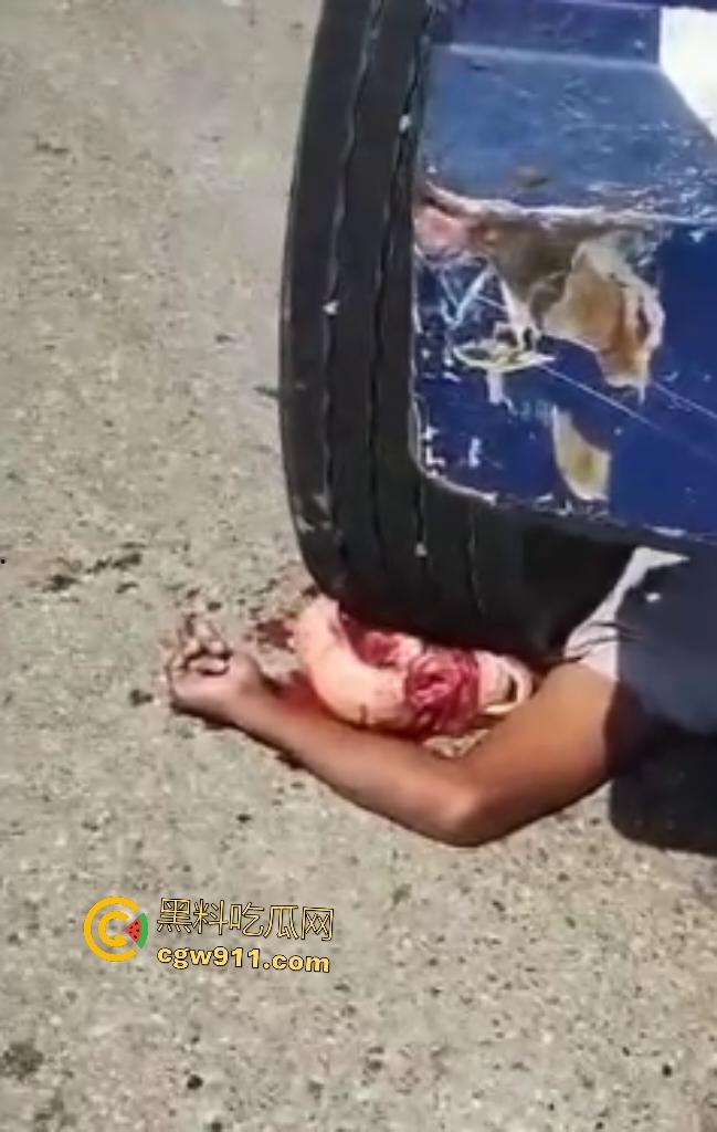 印尼摩托狂飙遭碾压！脑袋头皮刮飞露白骨，摩托吱吱狂响，车祸现场震碎人心，这还能救活吗？-3