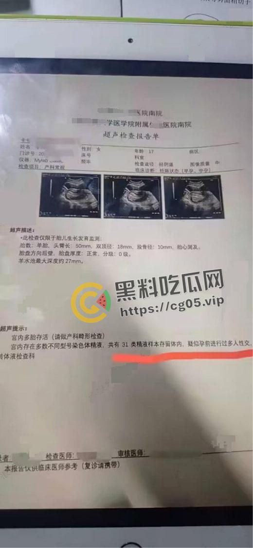 逆天大淫趴!30+男大战7女 其中不乏学生和艾滋病携带者 现场法医都给干吐了-6