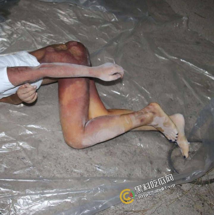 快手网红 史小越 被前男友设局骗至缅北后死亡事件！甜美淑女被冷冻死！尸检照片流出，面带微笑！-9