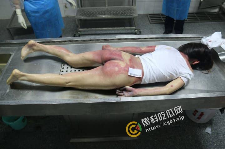 快手网红 史小越 被前男友设局骗至缅北后死亡事件！甜美淑女被冷冻死！尸检照片流出，面带微笑！-10