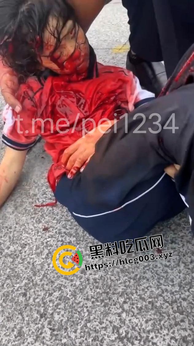 大瓜速递！江西贵溪特大伤人案现场视频流出 暴徒闯进校园狂杀老师和学生 血腥慎入-3