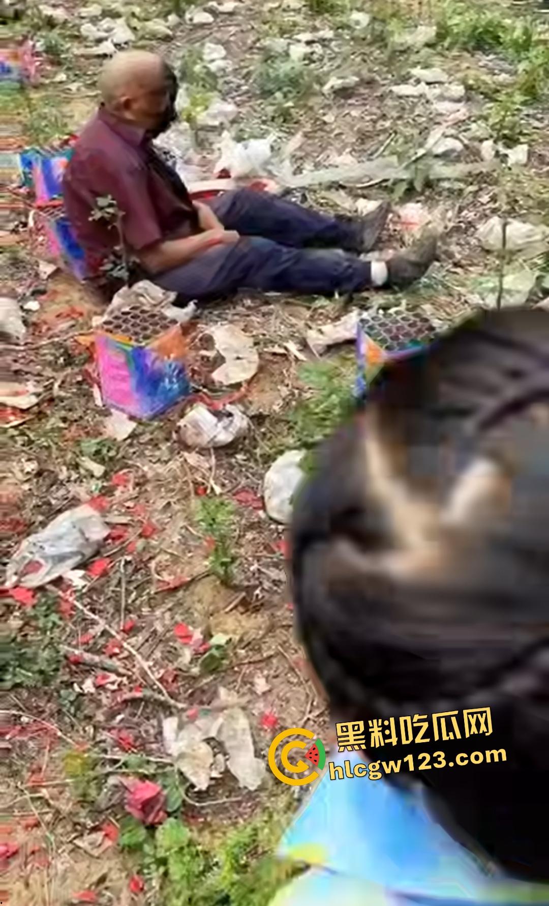 河南平顶山鲁山王大爷捡烟花炸头变黑鬼！右眼已瞎保不住，脑子里有骨头渣！-3