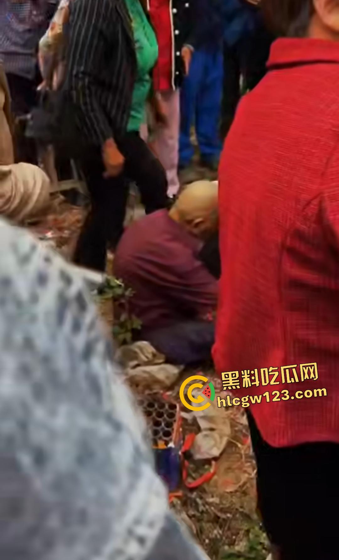 河南平顶山鲁山王大爷捡烟花炸头变黑鬼！右眼已瞎保不住，脑子里有骨头渣！-4