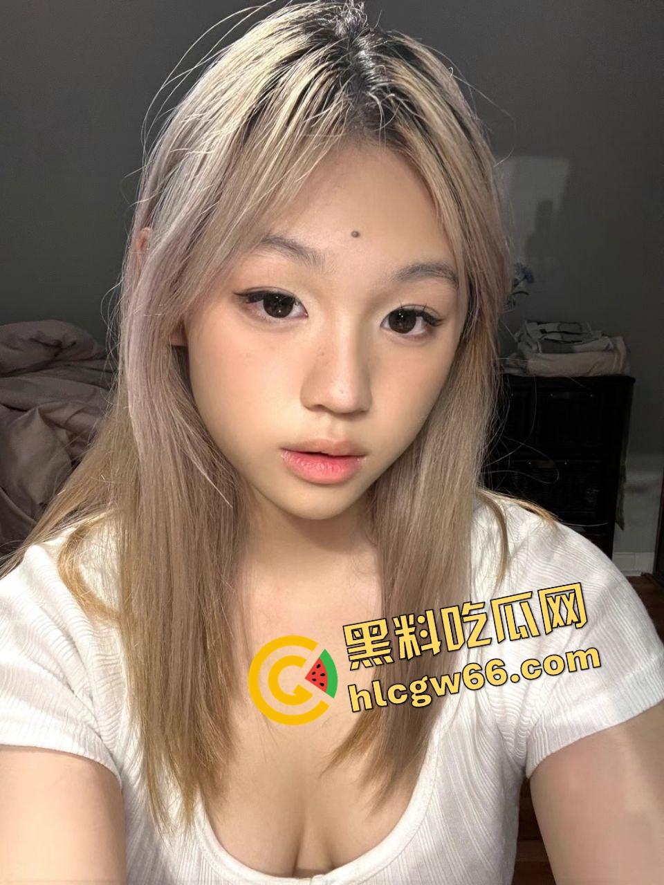 国产人妻【梦姐】挑战极限扩阴，骚逼拔火罐肿成馒头肉山，肿胀翻红像大肠包小肠！-2