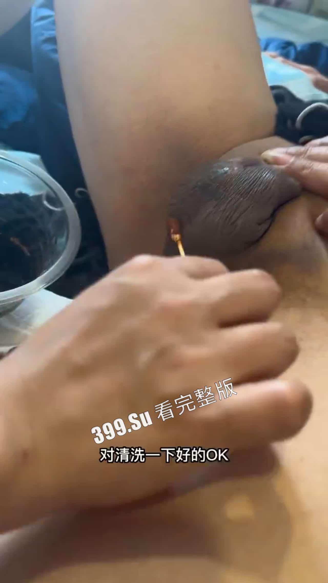 变性手术  术后实录  做女人啦！不过阴道真的有感觉嘛~瓜友们怎么看？-1