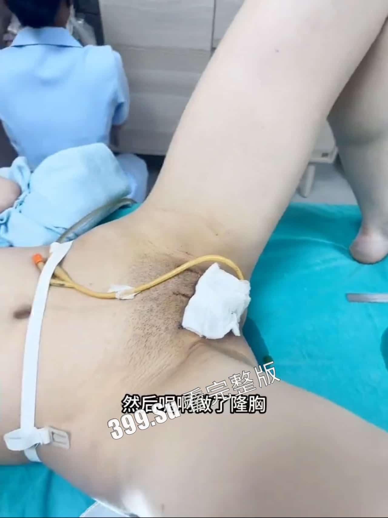 变性手术  术后实录  做女人啦！不过阴道真的有感觉嘛~瓜友们怎么看？-7