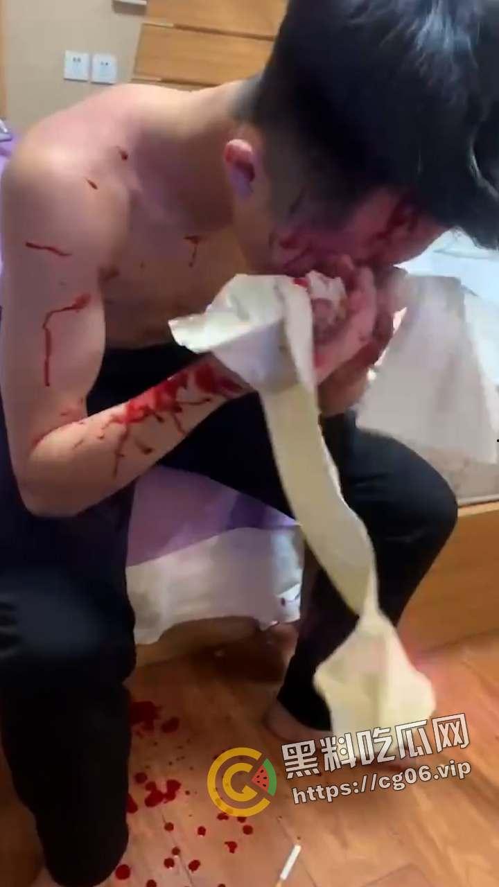 精神小伙1v3！小伙偷情兄弟女朋友 反被女人诬陷 带着闺蜜一起打 头干裂开了  现场血腥画面曝光-5