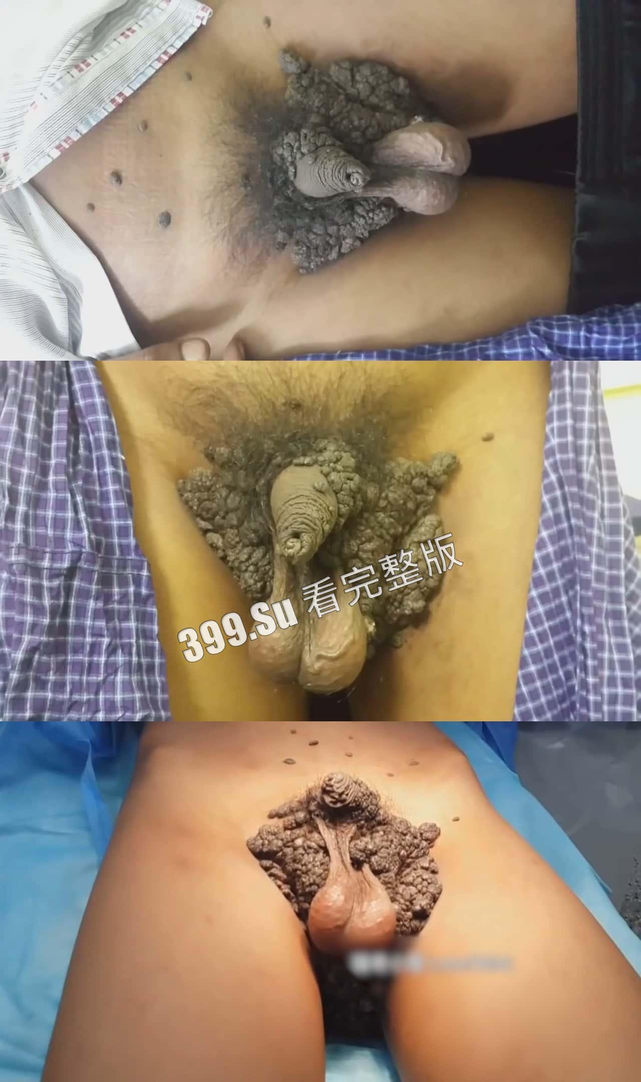 性病篇  谨慎观看！瓜友们出门在外 一定得洁身自爱 世界上没有后悔药  安全第一！！！-2