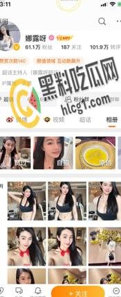 抖音 快手 微博 三栖网红「娜露呀」真正土豪福利流出 微密圈弱爆了！-1